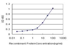 Anti-MAP2K5 Mouse Monoclonal Antibody [clone: M1-E6]