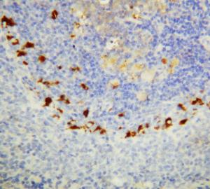 Anti-SOCS1 Rabbit Polyclonal Antibody