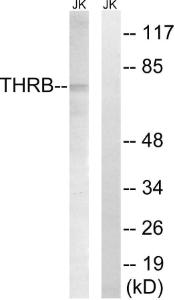 Western blot analysis of lysates from Jurkat cells, treated with etoposide 25uM 24H using Anti-THRB (AP2,cleaved Arg327) Antibody. The right hand lane represents a negative control, where the antibody is blocked by the immunising peptide