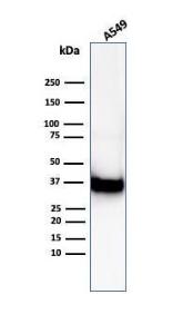 Western blot analysis of A549 cell line lysate using Anti-Annexin A1 Antibody [ANXA1/6452R]