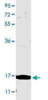 Anti-IL17A Rabbit Polyclonal Antibody