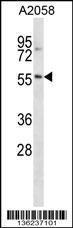 Anti-NACC2 Rabbit Polyclonal Antibody (AP (Alkaline Phosphatase))