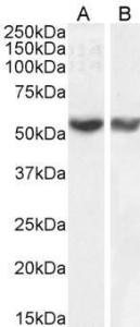 Anti-RNF8 Antibody (A82876) (1 µg/ml) staining of HepG2 (A) and Jurkat (B) nuclear cell lysate. (35 µg protein in RIPA buffer). Detected by chemiluminescence