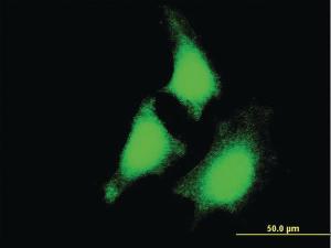 Anti-MAP2K5 Mouse Monoclonal Antibody [clone: 1E5]