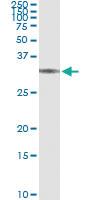 Anti-BRMS1 Antibody Pair