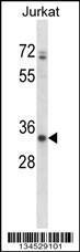 Anti-ART3 Rabbit Polyclonal Antibody (AP (Alkaline Phosphatase))