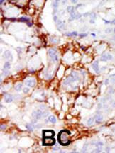 Anti-PAK3 Rabbit Polyclonal Antibody (Biotin)