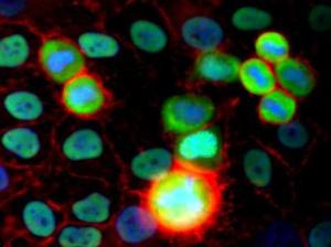 Immunofluorescence staining of HeLa human cervix carcinoma cell line using Anti-Ku80 Antigen Antibody (A85990) (detection by Goat Anti-Mouse IgG2a Alexa Fluor® 488/green). Actin (red) was stained with Phalloidin-TRITC, nuclei with DAPI (blue)