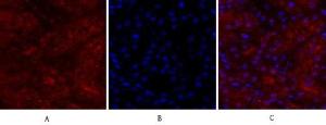 Immunofluorescence analysis of human stomach tissue using Anti-BRCA1 Antibody (red) at 1:200 (4°C overnight). Cy3 labelled secondary antibody was used at 1:300 (RT 50min). Panel A: Target. Panel B: DAPI. Panel C: Merge.