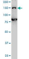 Anti-DHX8 Mouse Monoclonal Antibody [clone: 1E10]