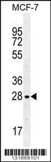 Anti-LGALS3 Rabbit Polyclonal Antibody