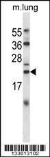 Anti-CRYAB Rabbit Polyclonal Antibody (APC (Allophycocyanin))