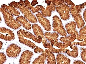 Immunohistochemical analysis of formalin-fixed, paraffin-embedded human stomach using Anti-Mucin 5AC Antibody [MUC5AC/917 + 45M1]