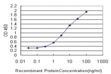 Anti-DHX8 Mouse Monoclonal Antibody [clone: 1E10]