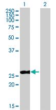 Anti-PPP2R3B Mouse Polyclonal Antibody