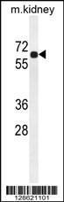 Anti-BCO2 Rabbit Polyclonal Antibody (HRP (Horseradish Peroxidase))