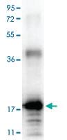 Anti-IL33 Rabbit Polyclonal Antibody