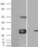 Anti-WISP1 antibody