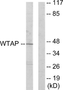 Western blot analysis of lysates from HUVEC cells using Anti-WTAP Antibody The right hand lane represents a negative control, where the antibody is blocked by the immunising peptide