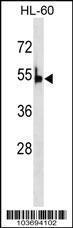 Anti-PKLR Rabbit Polyclonal Antibody (HRP (Horseradish Peroxidase))