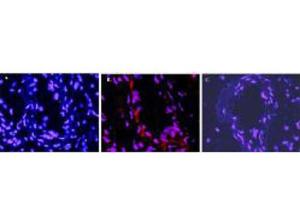 PAB Rabbit IL1 beta MS IgG 100 µg ELISA