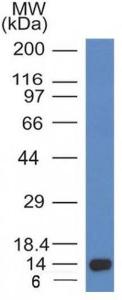 Western blot analysis of recombinant fragment of ALK using Anti-ALK Antibody [ALK/1032]