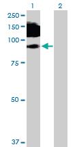 Anti-MCAM Mouse Polyclonal Antibody