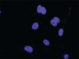 Anti-E2F2 Antibody Pair