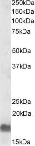 Anti-EDF1 Antibody (A82880) (0.3 µg/ml) staining of A549 lysate (35 µg protein in RIPA buffer). Primary incubation was 1 hour. Detected by chemiluminescence