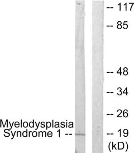 Western blot analysis of lysates from A549 cells using Anti-Myelodysplasia Syndrome 1 Antibody. The right hand lane represents a negative control, where the Antibody is blocked by the immunising peptide