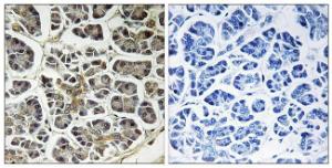 Immunohistochemical analysis of paraffin-embedded human pancreas using Anti-ATP5G2 Antibody. The right hand panel represents a negative control, where the antibody was pre-incubated with the immunising peptide