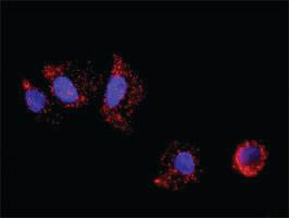 Anti-E2F2 Antibody Pair