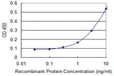 Anti-DHX9 Mouse Monoclonal Antibody [clone: 1D10]