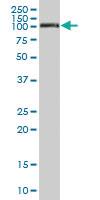 Anti-MCAM Mouse Polyclonal Antibody