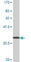 Anti-MAPK8 Mouse Monoclonal Antibody [clone: 3H2]