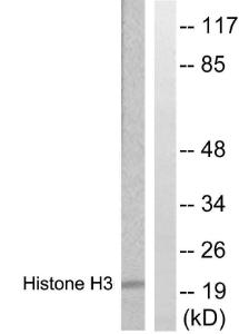 Western blot analysis of lysates from HUVEC cells, treated with Serum 20% 30' using Anti-Histone H3 Antibody. The right hand lane represents a negative control, where the antibody is blocked by the immunising peptide