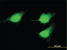 Anti-MAP2K5 Mouse Monoclonal Antibody [clone: 2C2]