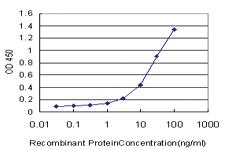 Anti-TLR7 Mouse Monoclonal Antibody [clone: 2F6]