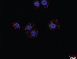 Anti-E2F2 Antibody Pair