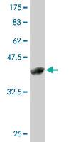 Anti-ZMAT4 Mouse Monoclonal Antibody [clone: 7H3-1C11]