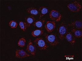 Anti-E2F2 Antibody Pair