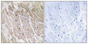 Immunohistochemical analysis of paraffin-embedded human heart using Anti-ACAD10 Antibody. The right hand panel represents a negative control, where the Antibody was pre-incubated with the immunising peptide