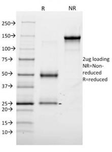 SDS-PAGE analysis of Anti-Annexin A1 Antibody [6E4/3] under non-reduced and reduced conditions; showing intact IgG and intact heavy and light chains, respectively. SDS-PAGE analysis confirms the integrity and purity of the antibody