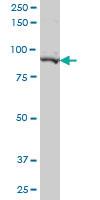 Anti-PEAK1 Mouse Monoclonal Antibody [clone: 3E7]