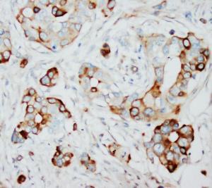 Anti-SKP2 Rabbit Polyclonal Antibody