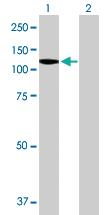 Anti-DDX11 Mouse Polyclonal Antibody