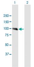 Anti-MCC Mouse Polyclonal Antibody