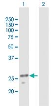 Anti-ULK3 Mouse Polyclonal Antibody