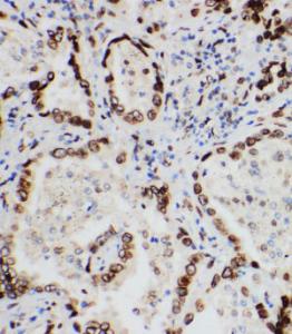 Anti-Lamin A+C Rabbit Polyclonal Antibody