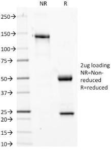 SDS-PAGE analysis of Anti-Phosphotyrosine Antibody [PY20] under non-reduced and reduced conditions; showing intact IgG and intact heavy and light chains, respectively. SDS-PAGE analysis confirms the integrity and purity of the antibody